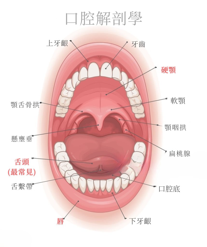 口腔灼熱症候群常見影響部位